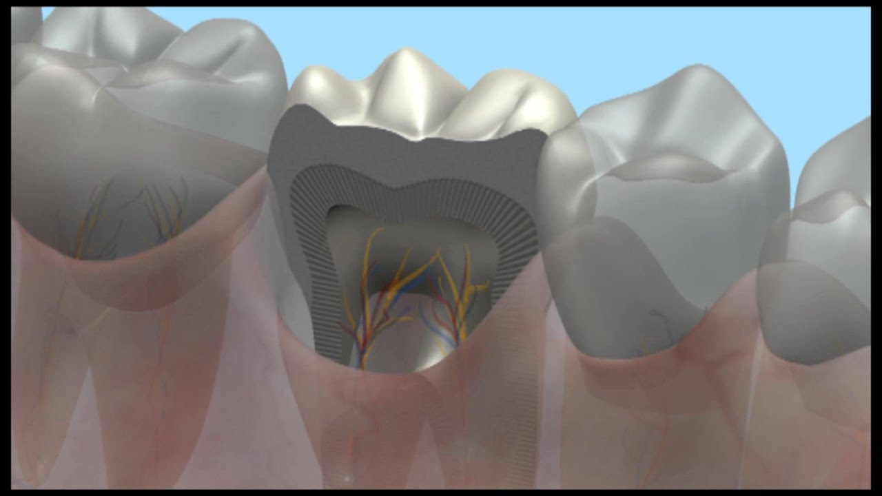 ApaCare видеоролик