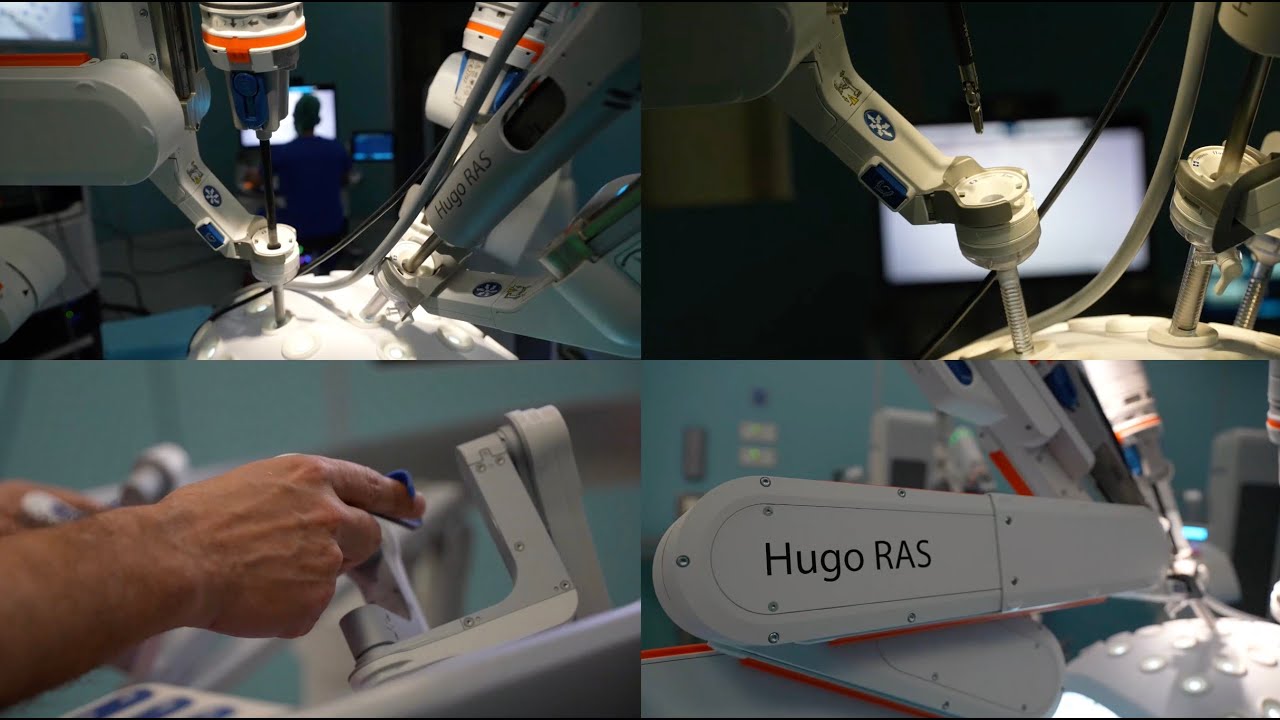 All’ospedale Miulli arriva Hugo, il nuovo sistema di chirurgia robot-assistita