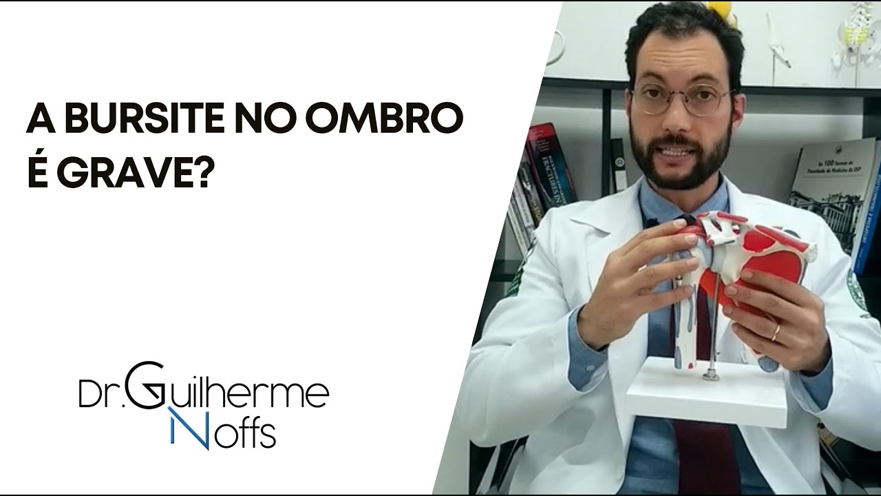 Is shoulder bursitis serious? - Dr. William Noffs