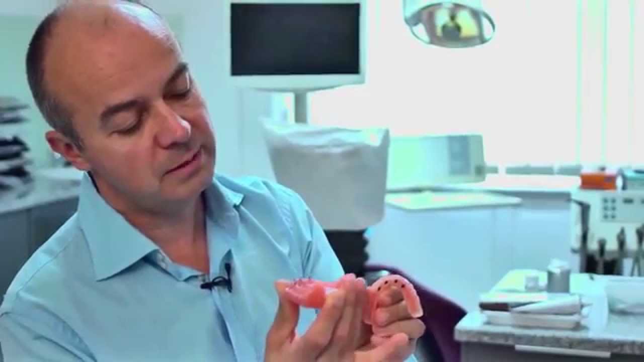 Mennyire lesz stabil a műfogsor a prot&eacute;zisr&ouml;gz&iacute;t&eacute;s ut&aacute;n?