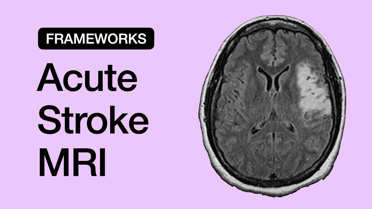 MR Imaging in Acute Stroke: Basics