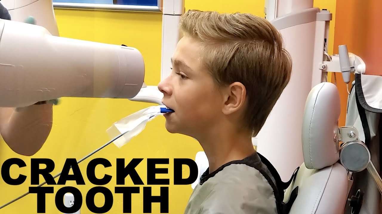 CRACKED TOOTH and CAVITIES at Dentist Appointment!
