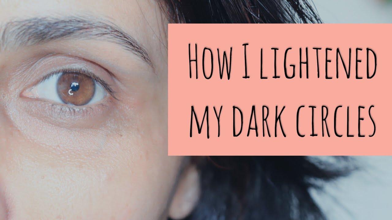 कैसे कम किए मैंने अपने  DARK CIRCLES?? Finally I am answering