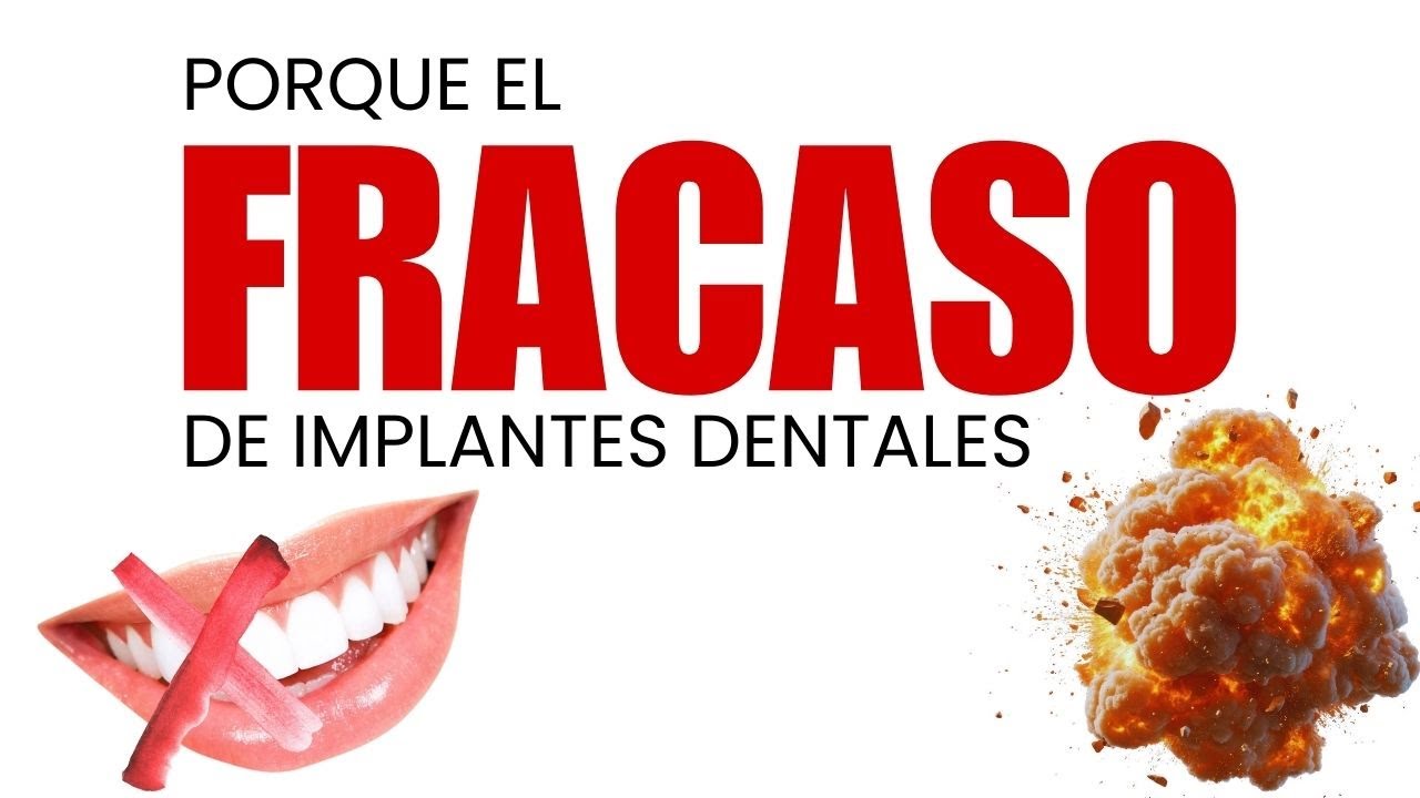 😢Implantes Dentales que fallan: la verdad sobre la preparación ósea / #culiacan Dr Ivan Meza