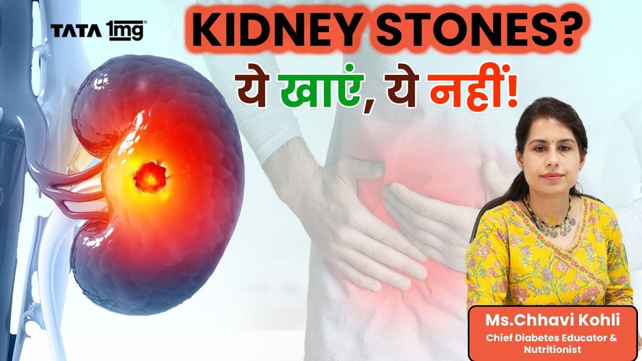 Kidney Stone Diet Plan | Foods to Eat and Avoid