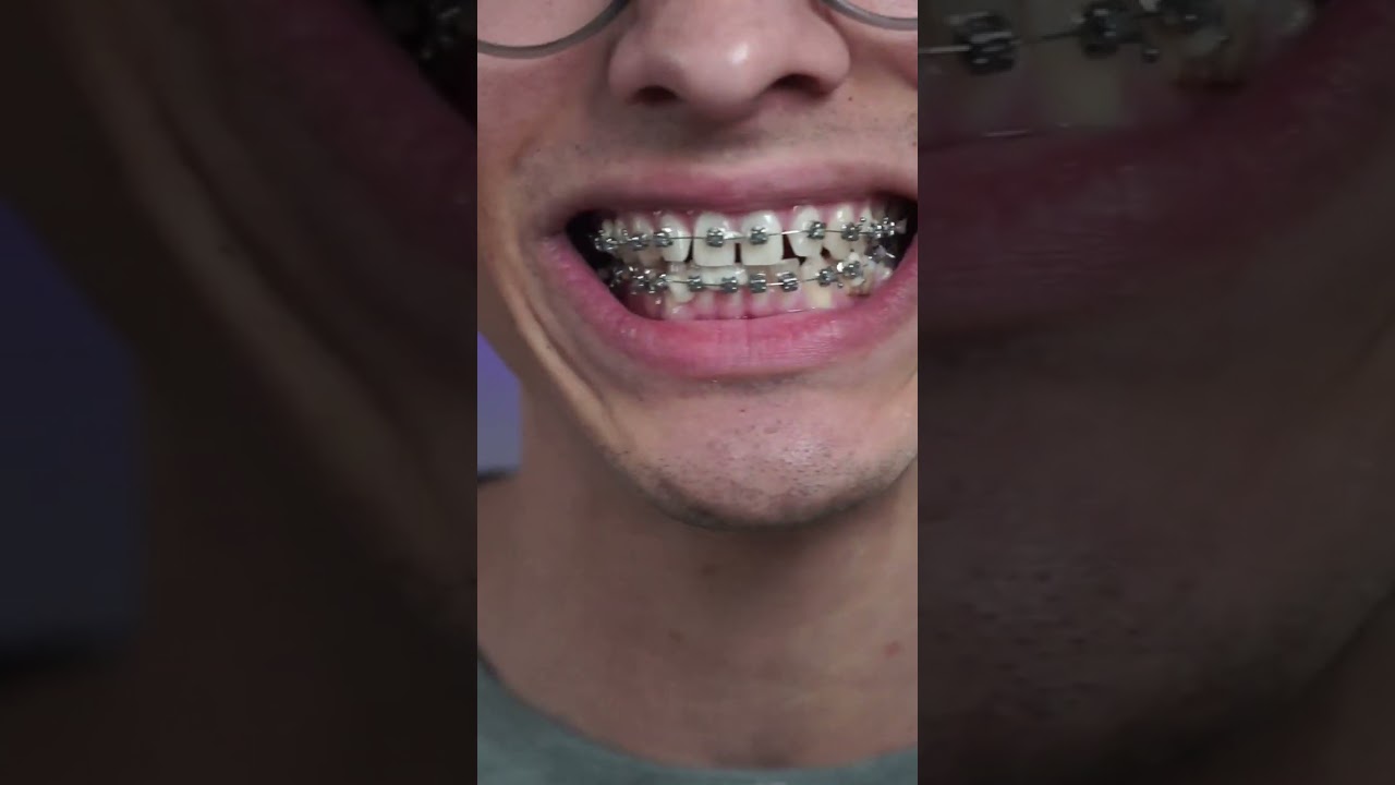 What REALLY Happens When You Eat a Taco and Banana?
