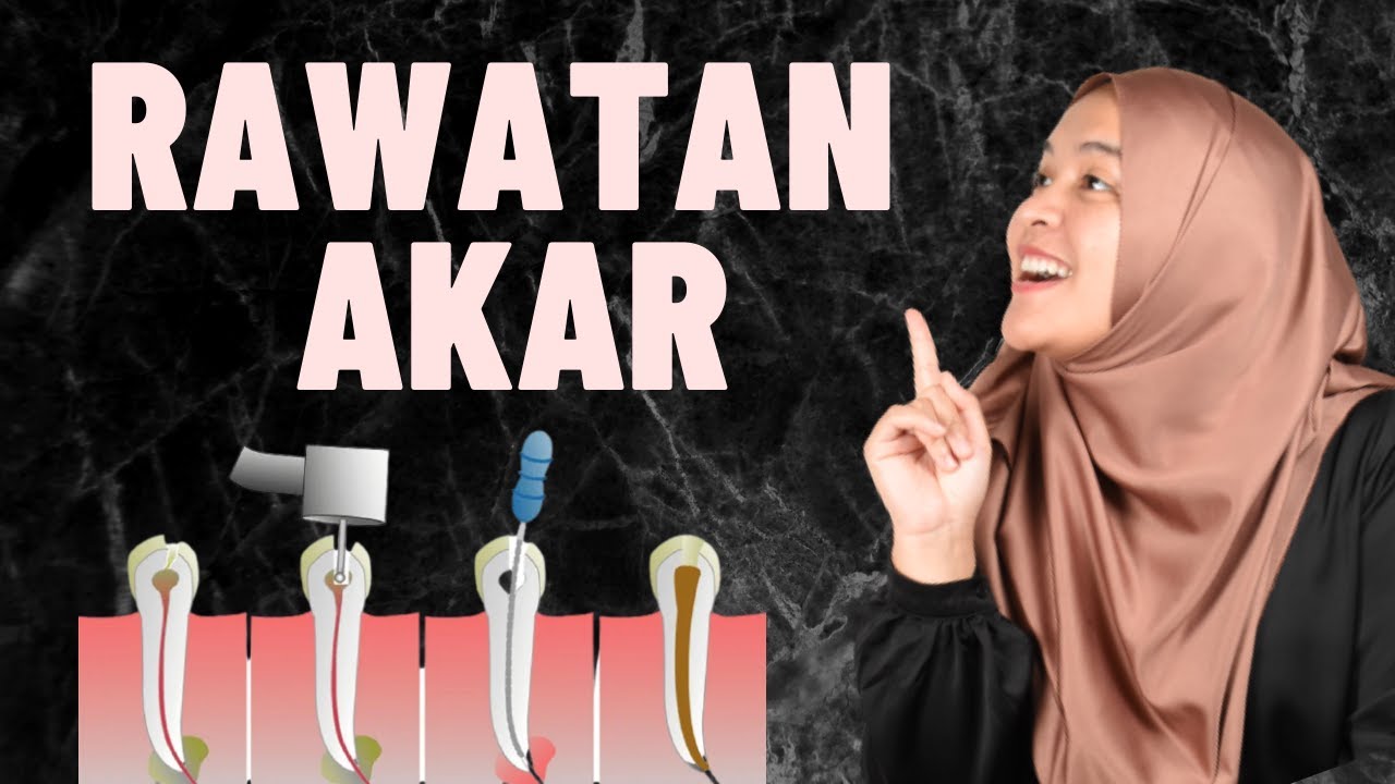 APA SEBENARNYA RAWATAN AKAR NI?