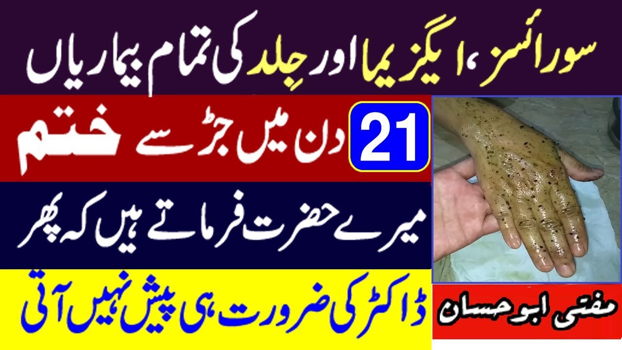 Skin Allergy ka ilaj - Jild ki Bimari ka ilaj - Psoriasis Eczema ka ilaj - Acne Pimple ka ilaj