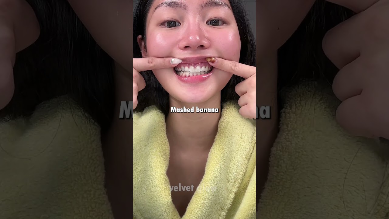 Her Teeth Look Professionally Whitened... But It&rsquo;s DIY 👀💎
