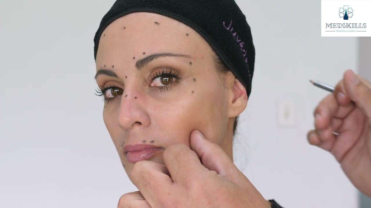 Full Face Toxin Markings with face map