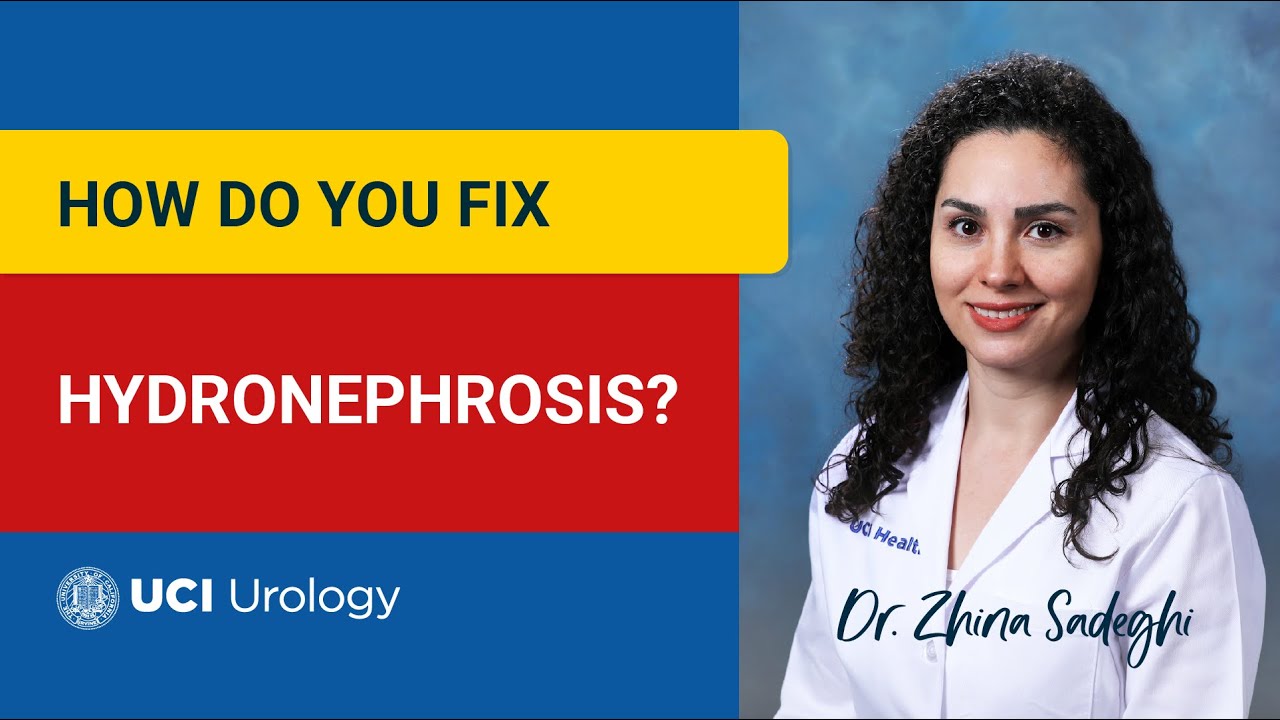 How Do You Fix Hydronephrosis? by Dr. Zhina Sadeghi - UC Irvine Department of Urology