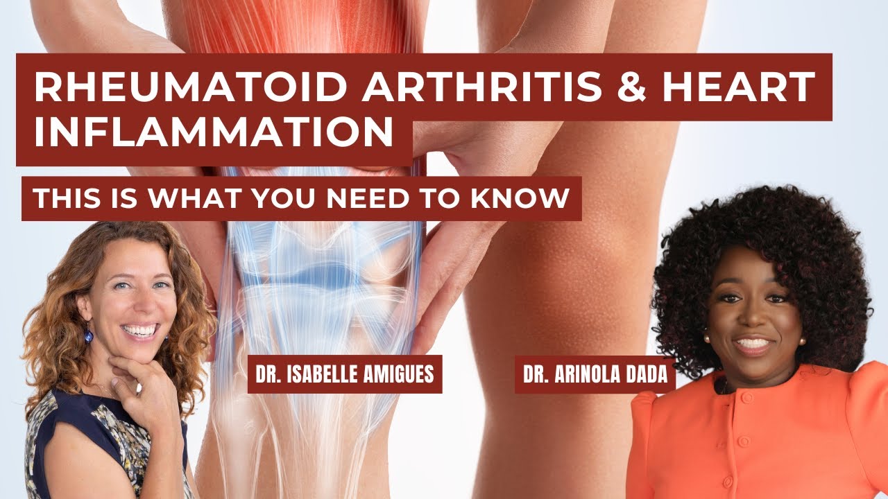 Health Talk | Rheumatoid Arthritis & Heart Inflammation| With @UnabridgedMD1