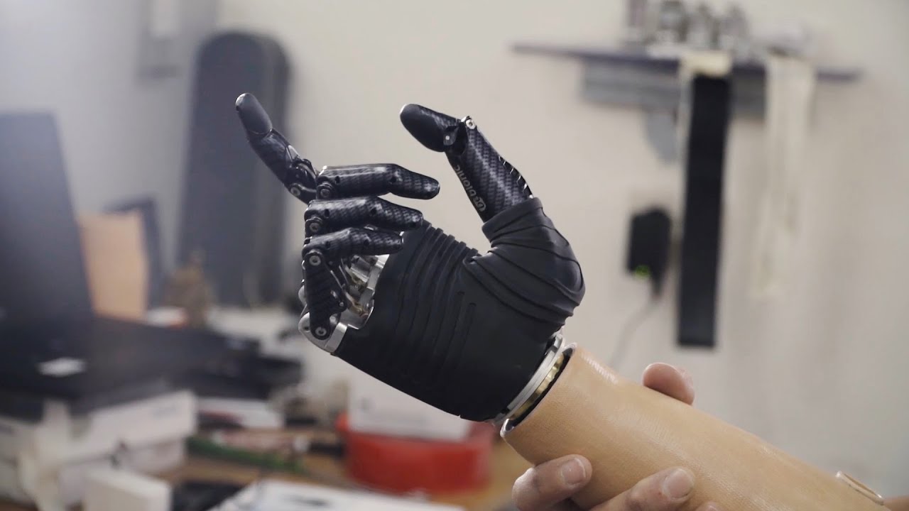 Prótesis de mano Bebionic