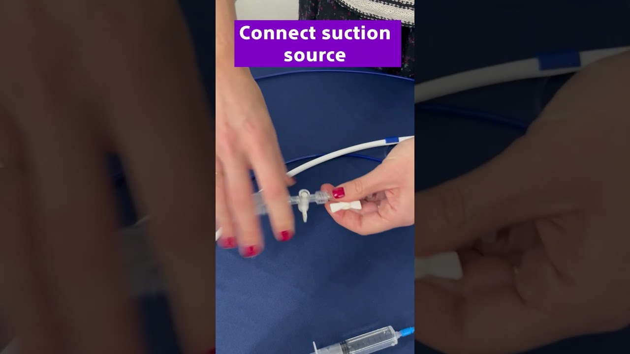 Master SpyGlass DS II Setup in Minutes: Quick Guide for Endoscopists! | Boston Scientific