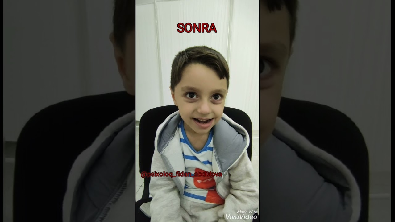 Psixi inkişaf ləngiməsi, Nitq ləngiməsi