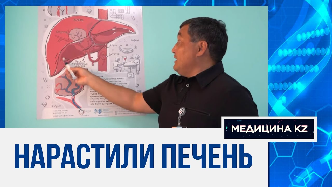 Казахстанские хирурги нарастили пациенту печень с помощью инновационных методов | Медицина KZ
