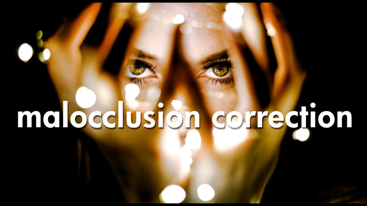 ULTIMATE MALOCCLUSION CORRECTION - Subliminal Affirmations