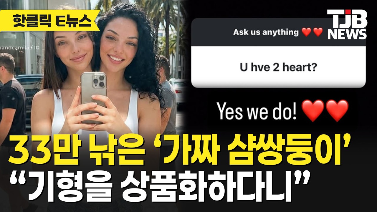 33만 낚은 &lsquo;가짜 샴쌍둥이&rsquo; &ldquo;기형을 상품화하다니&rdquo;｜ TJB 대전&middot;세종&middot;충남뉴스
