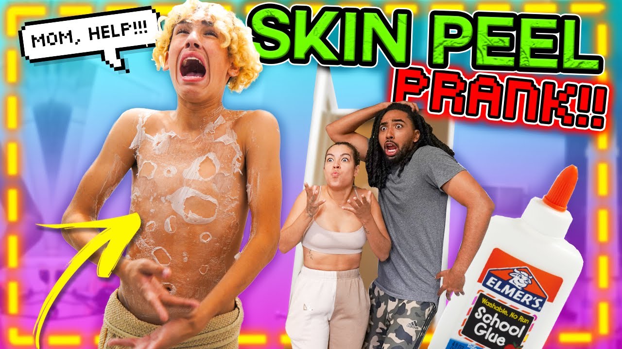 MY SKIN IS PEELING PRANK on my PARENTS!! *THEY GO CRAAZY* 🤣