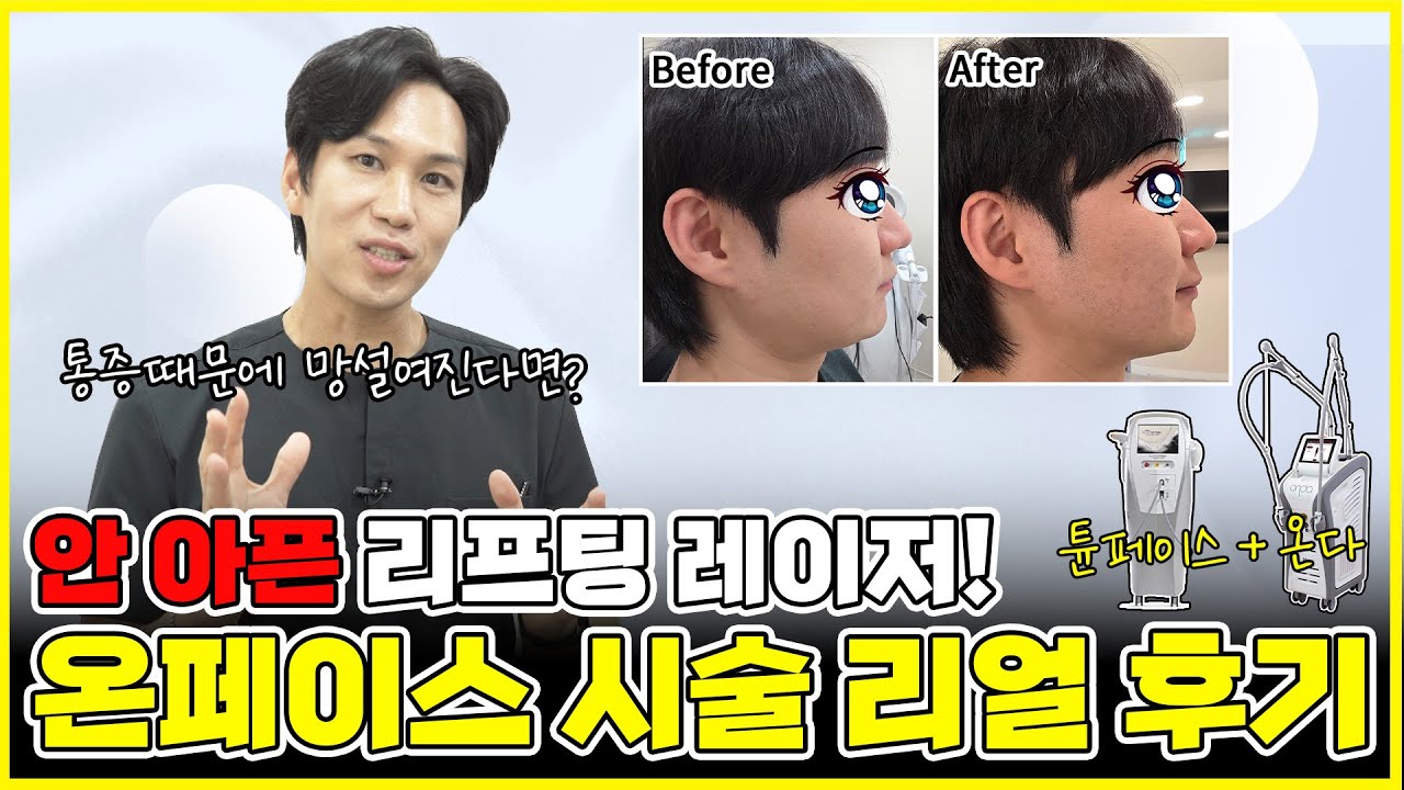 통찔이들도 할 수 있는 안 아픈 리프팅레이저! 하지만 효과는 따블? 온다리프팅, 튠페이스의 환상적인 조합 &lsquo;온페이스&rsquo;시술과정 공개! 천호온다리프팅, 천호튠페이스
