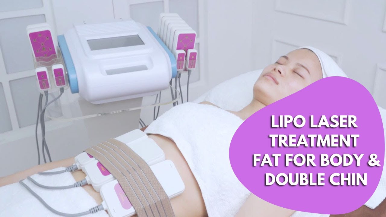 Lipo Laser | Lipo Laser Treatment | Lipo Laser Fat for Double Chin| Lipo Laser Fat | myChway 16101
