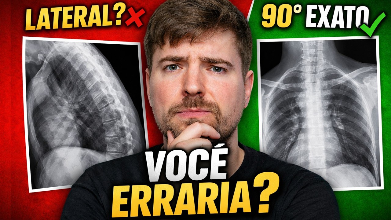90% dos Alunos ERRAM Posições na Radiologia (Você Também?)
