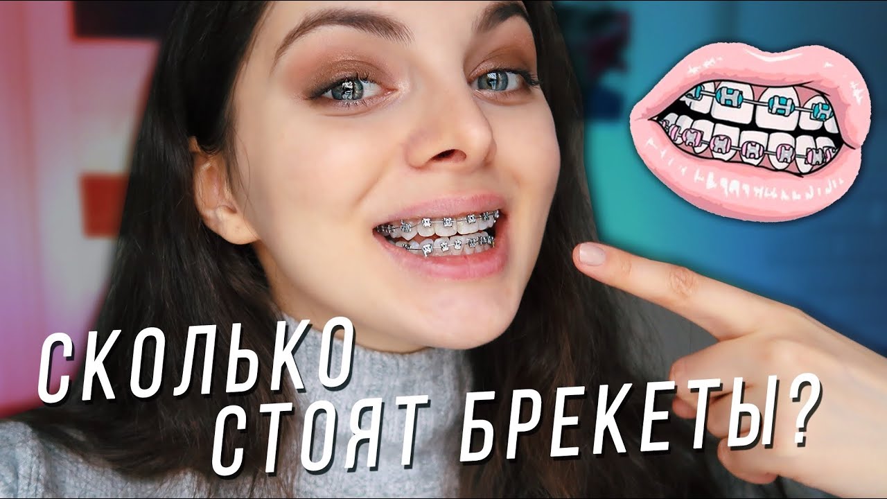 ПЕРВЫЕ ДНИ С БРЕКЕТАМИ / Сколько стоят мои брекеты?