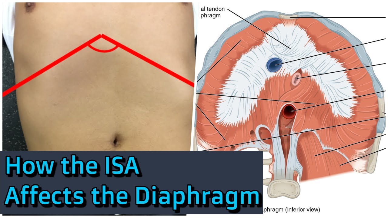 How the Infrasternal Angle Affects Diaphragm Position