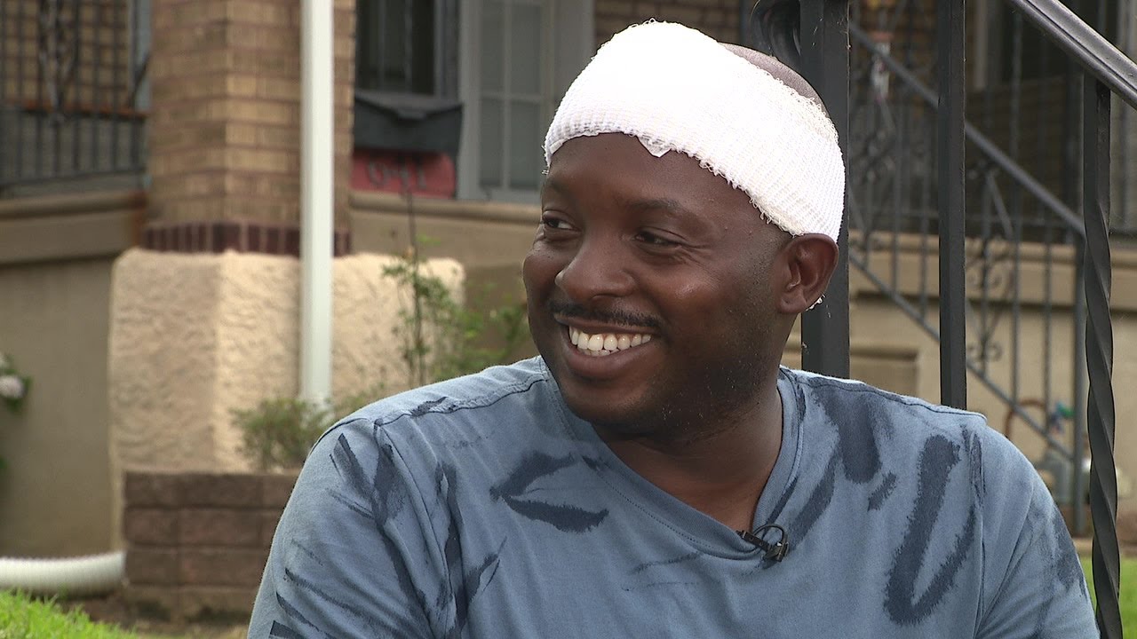 Philadelphia police officer grazed in head by bullet during 4th of July festivities shares his exper