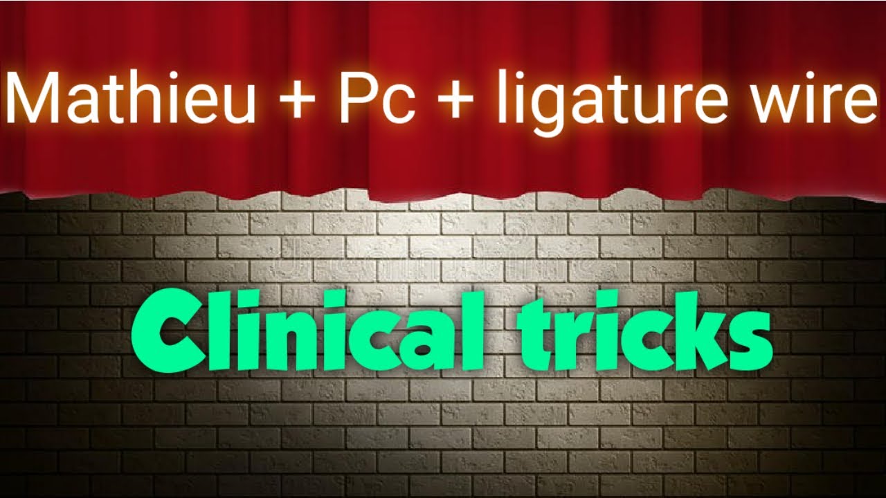 Orthodontic trick ... ligature wire + Power-chain + Mathieu
