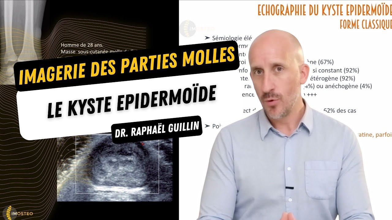 Tutoriel IMOSTEO #2 : le kyste épidermoïde