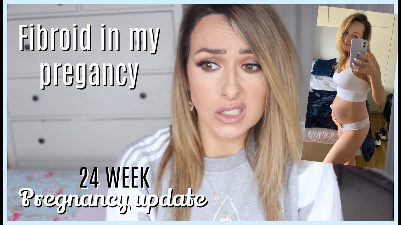 UPDATE ON FIBROID DURING MY PREGNANCY | pain, baby growth, has it shrunk?