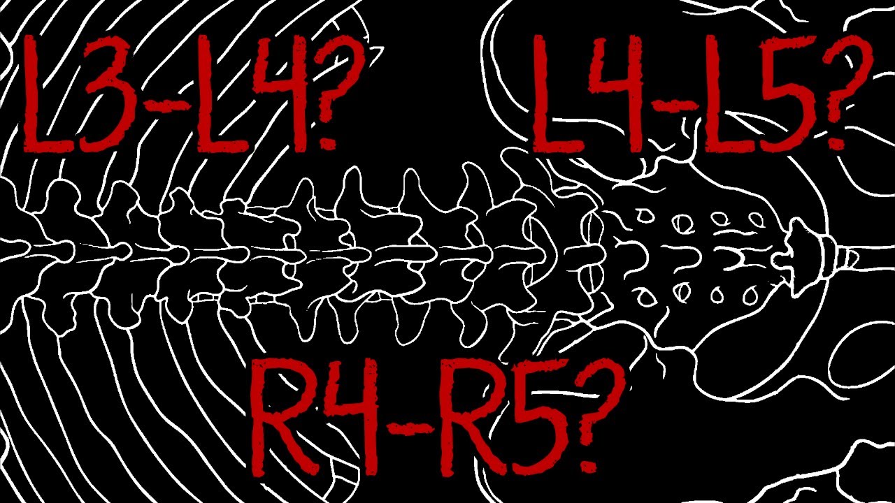 DSP's back injury: an analysis of a lie.