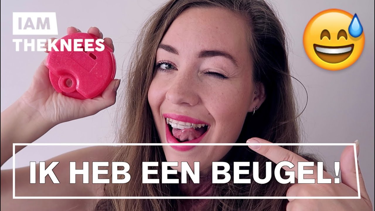OMG! HOE MOET IK MIJN BEUGEL VERBERGEN?! // FASHION DILEMMA'S #21 | ♥ iamtheknees