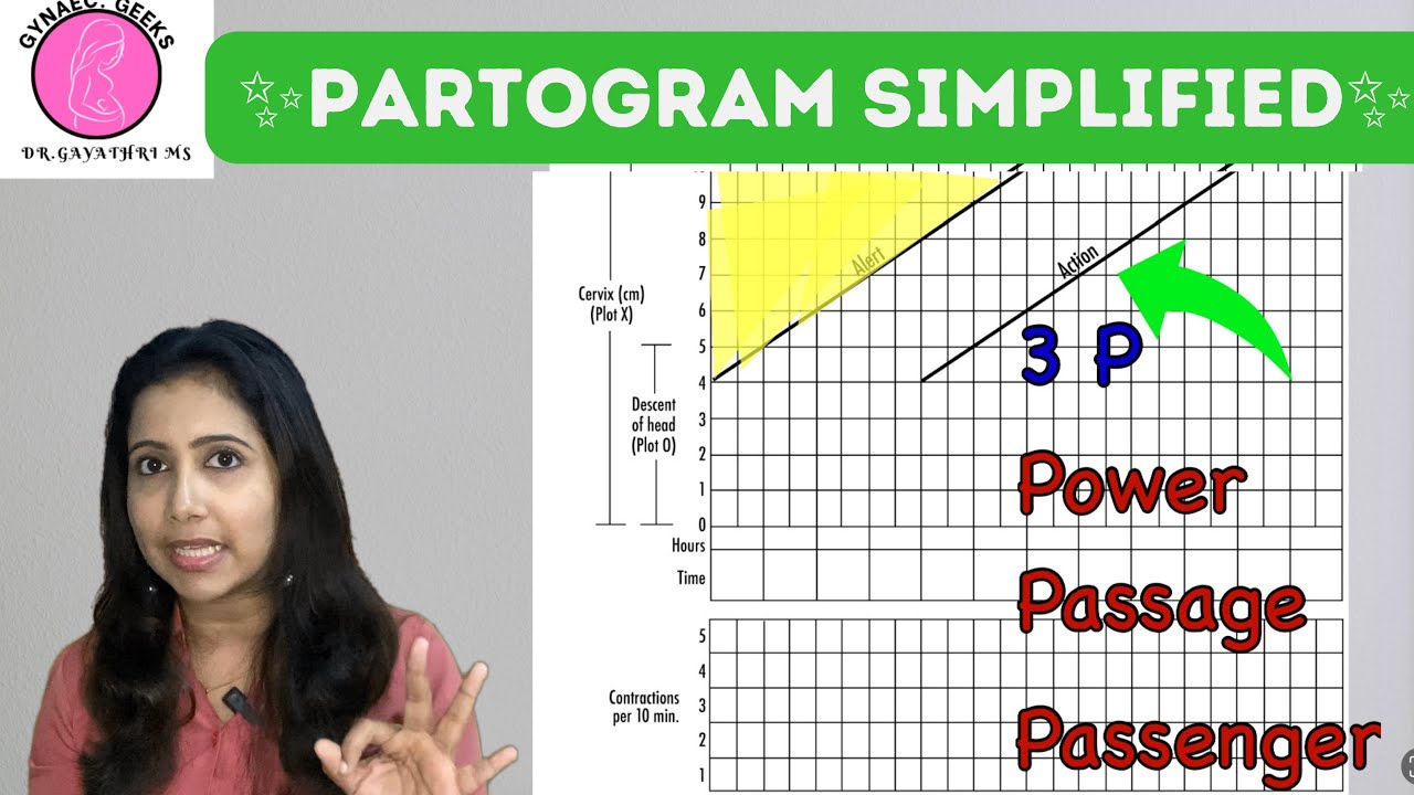 ✨PARTOGRAM SIMPLIFIED ✨✨