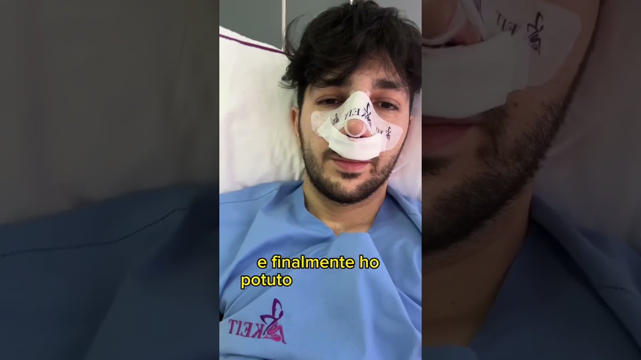Ecco perch&eacute; mi sono operato qui #chirurgiaplastica #chirurgia #naso