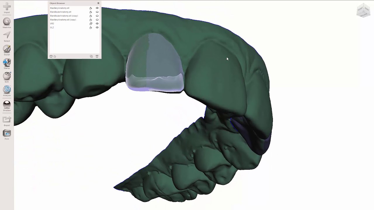 MeshMixer - Single Tray Ortho Correction
