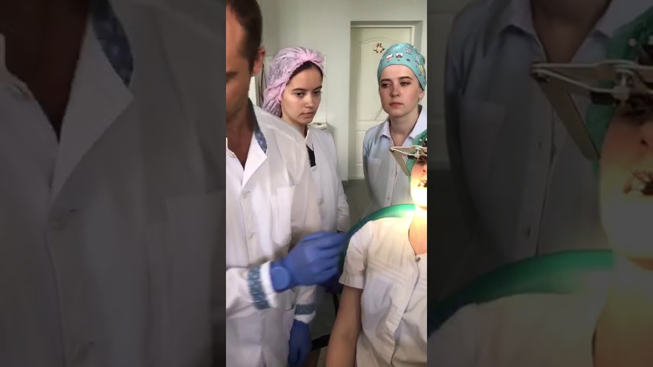 Как установить лицевую дугу ?