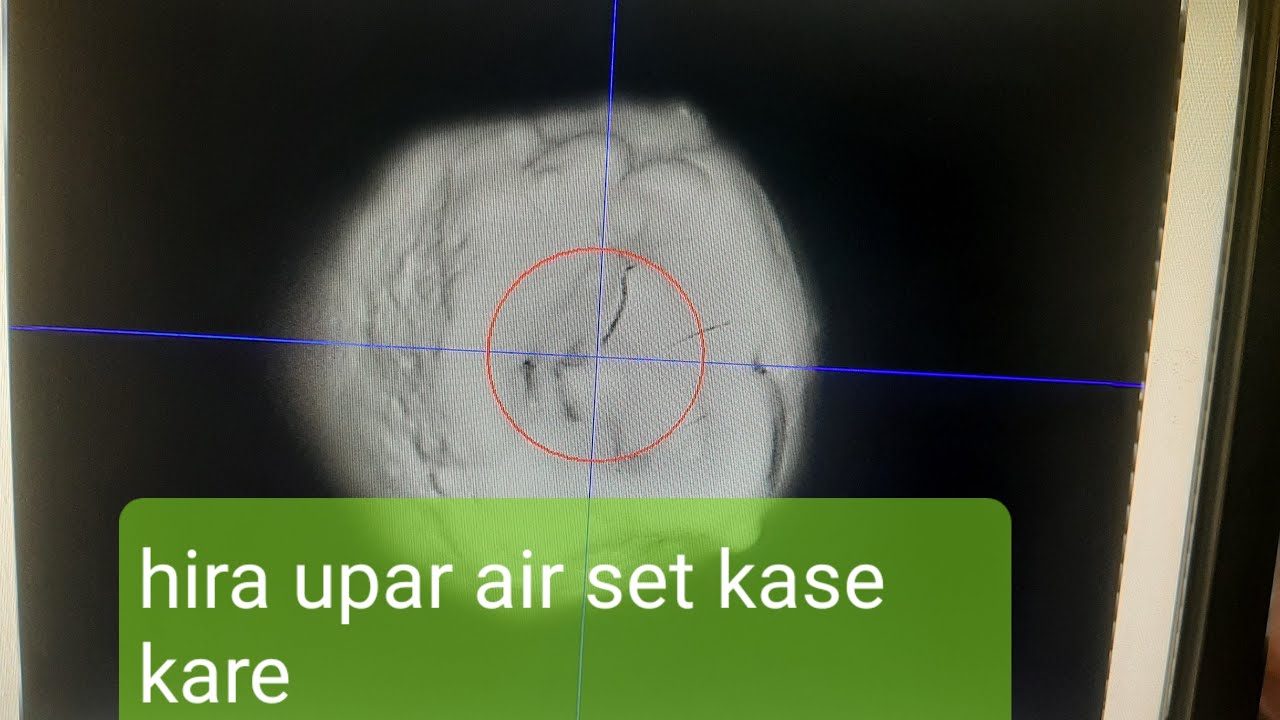Hira upar air set kai rite karvi