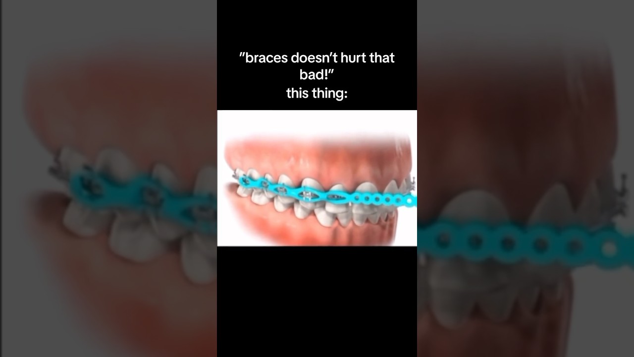 Top 5 Most PAINFUL Things About Braces! 😭🦷