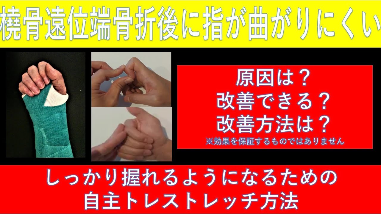 橈骨遠位端(手首)骨折後に指が固い(曲がりにくい)を解決するストレッチ