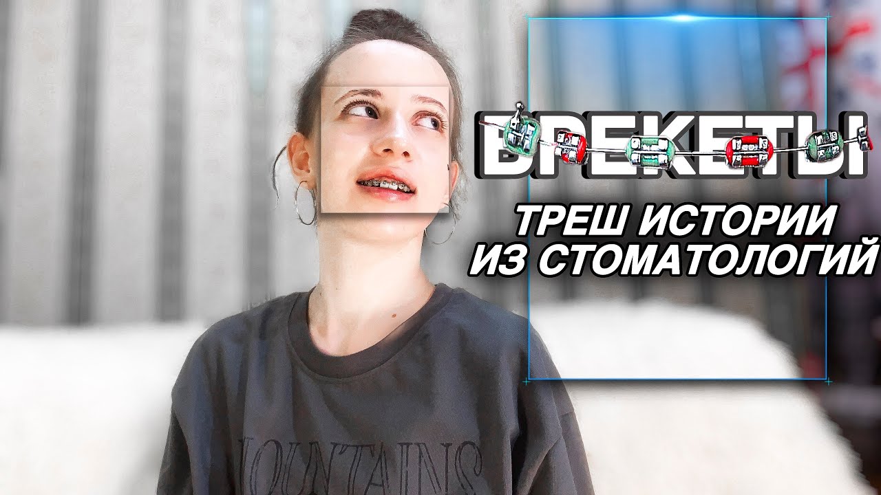 ВСЯ ПРАВДА О БРЕКЕТАХ  / ТРЕШ ИСТОРИИ ИЗ СТОМАТОЛОГИЙ