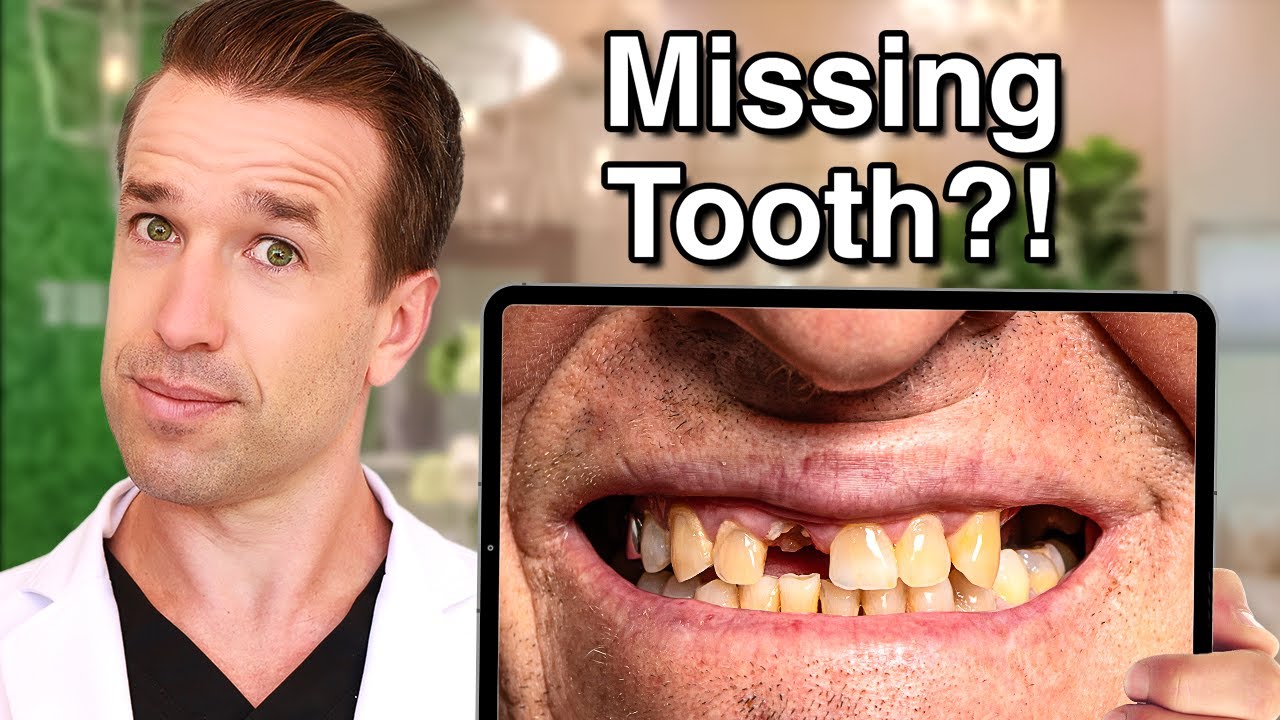 Best way to replace a MISSING TOOTH (tooth replacement options)