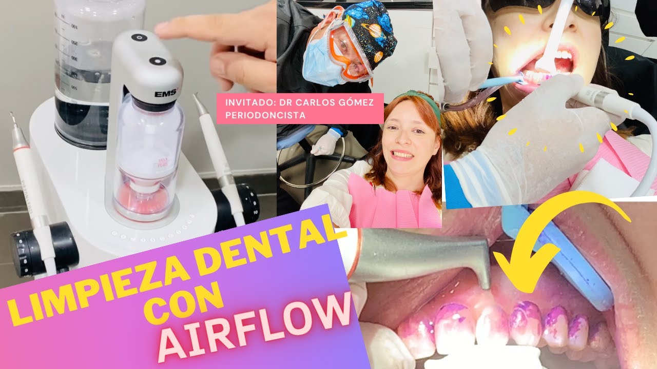 AIRFLOW: Limpieza Dental con agua a presión y polvo con clorhexidina 🦷 ¡sin dolor! 👄 😱