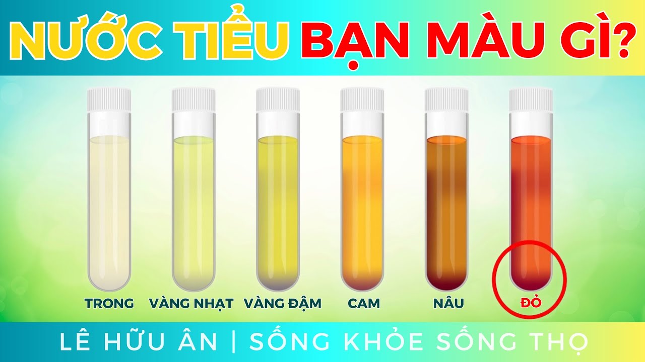 M&Agrave;U NƯỚC TIỂU n&oacute;i g&igrave; về SỨC KHOẺ CỦA BẠN ( Hướng dẫn xem NƯỚC TIỂU  biết BỆNH )