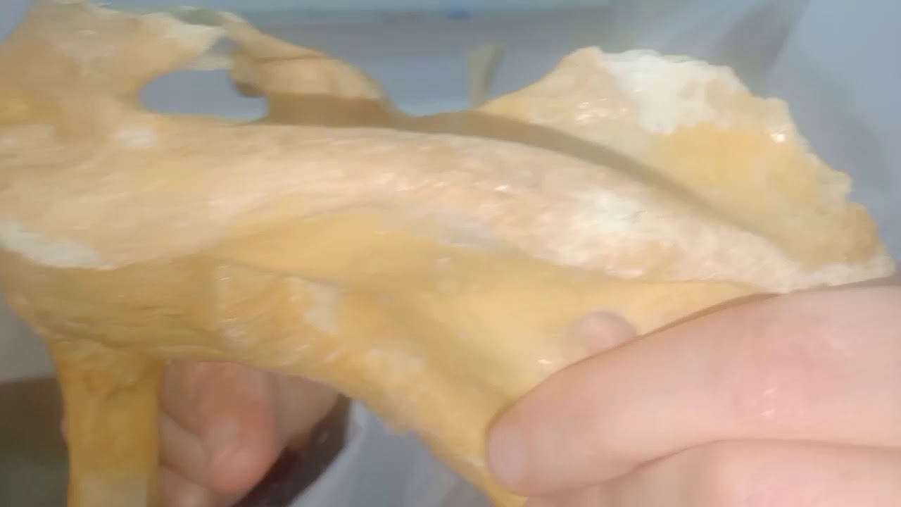 articulation scapulo-huméale