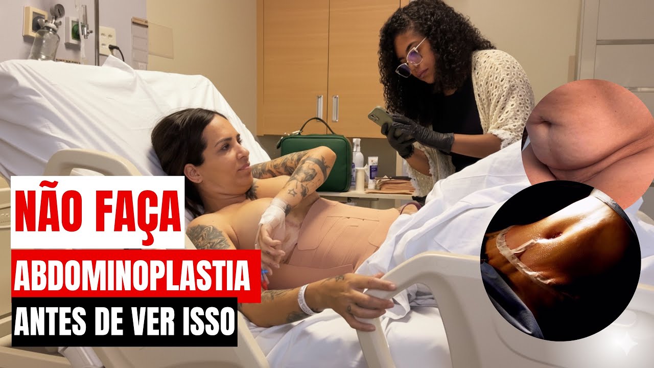  O QUE NÃO TE CONTA SOBRE O PÓS DA ABDOMINOPLASTIA, LIPO 360 E ENXERTO DE GLÚTEO