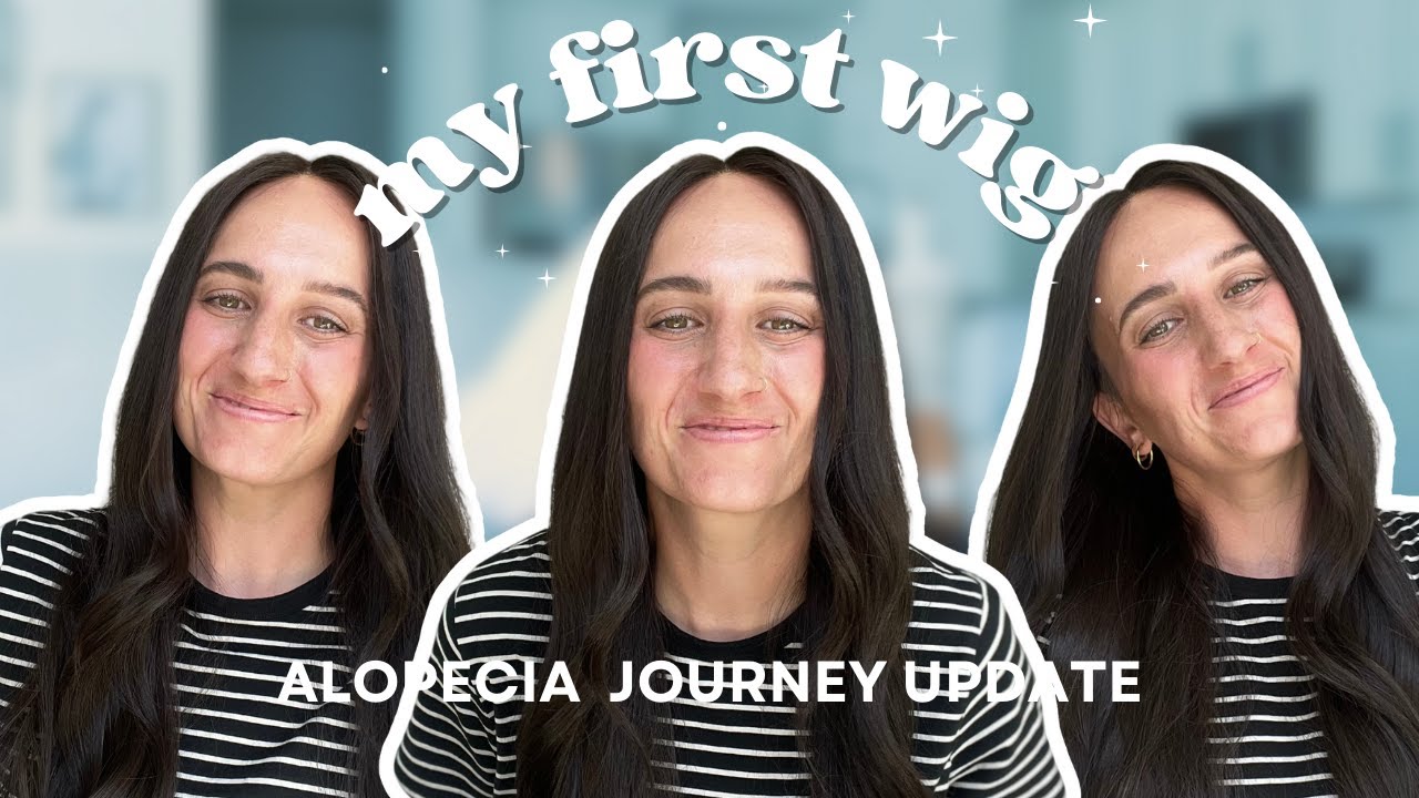 Putting on a Wig for the First Time Since My Alopecia Diagnosis | Emotional Transformation
