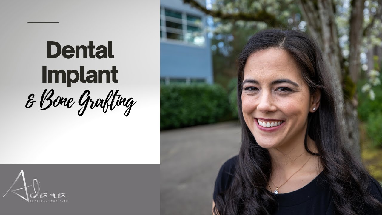 Bone Grafting & Dental Implant Procedure With Same Day Results!