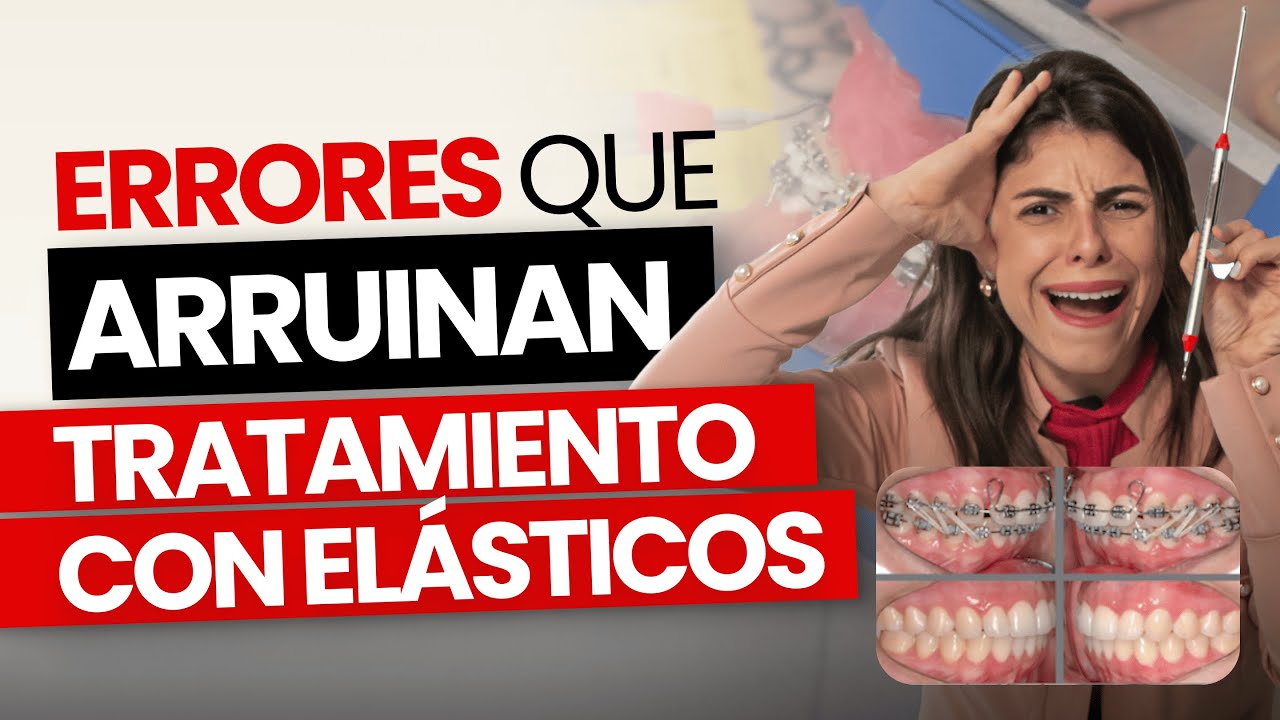 LOS PRINCIPALES ERRORES DE QUIÉN NO APLICA BIEN LOS ELÁSTICOS INTERMAXILARES